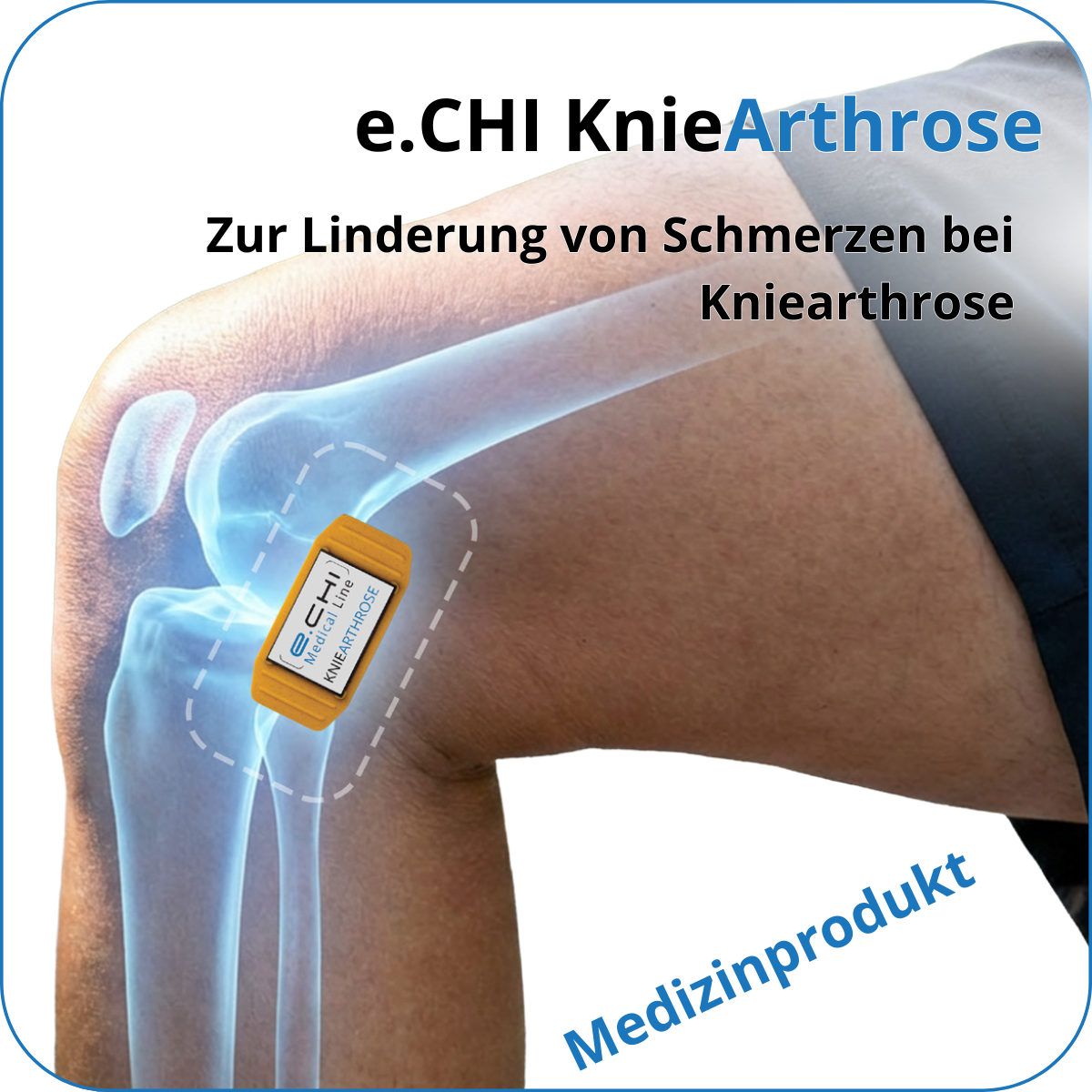 KnieArthrose (Medizinprodukt)